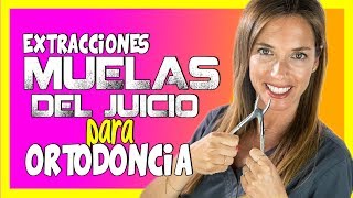 🔵¿Es necesario QUITAR MUELAS DEL JUICIO para poner BRACKETS🔵ORTODONCIA y MUELAS DEL JUICIO