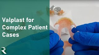 Valplast Dentures for Complex Patient Cases