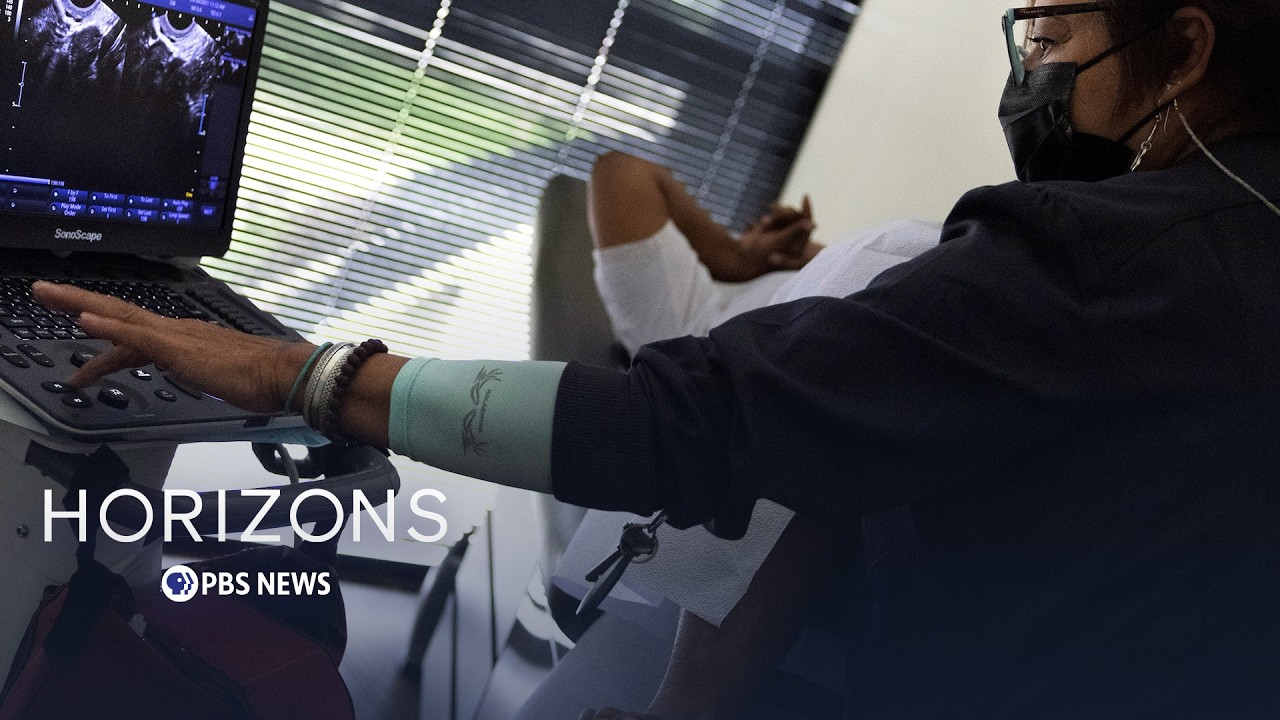 Video: PBS segment details uterine fibroids affecting 70-80% of women, higher rates in Black women