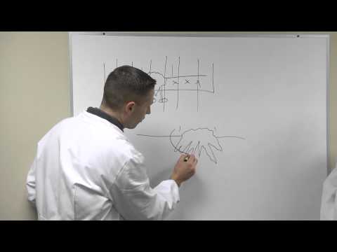 Mohs Technique for Skin Cancer Removal | Billings Clinic