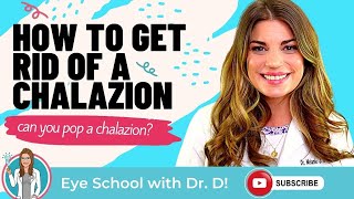 How to get rid of a chalazion? What happens if a chalazion is untreated? Can you pop a chalazion?