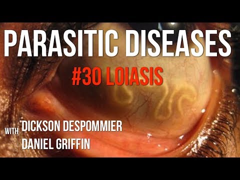 Parasites Without Borders, Parasitic Diseases Lectures #30: Loiasis