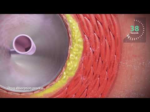 INPACT Admiral Drug Coated Balloon