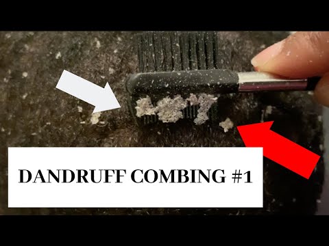 Dandruff combing #1  BIG FLAKES