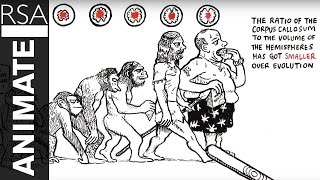 The Divided Brain