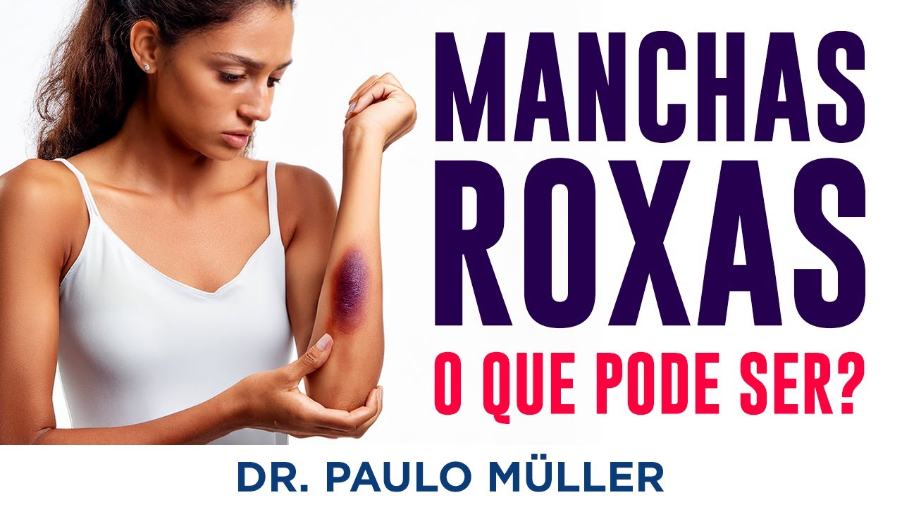 Manchas Roxas na Pele, O Que Pode Ser? – Dr. Paulo Müller Dermatologista.