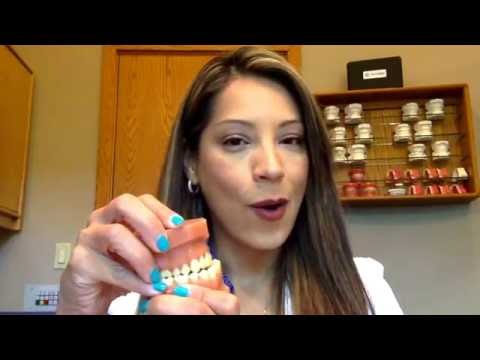 How to Wear Your Rubber Bands