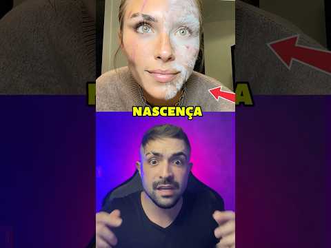 O que sua marca de nascença diz SOBRE SUA VIDA passada?