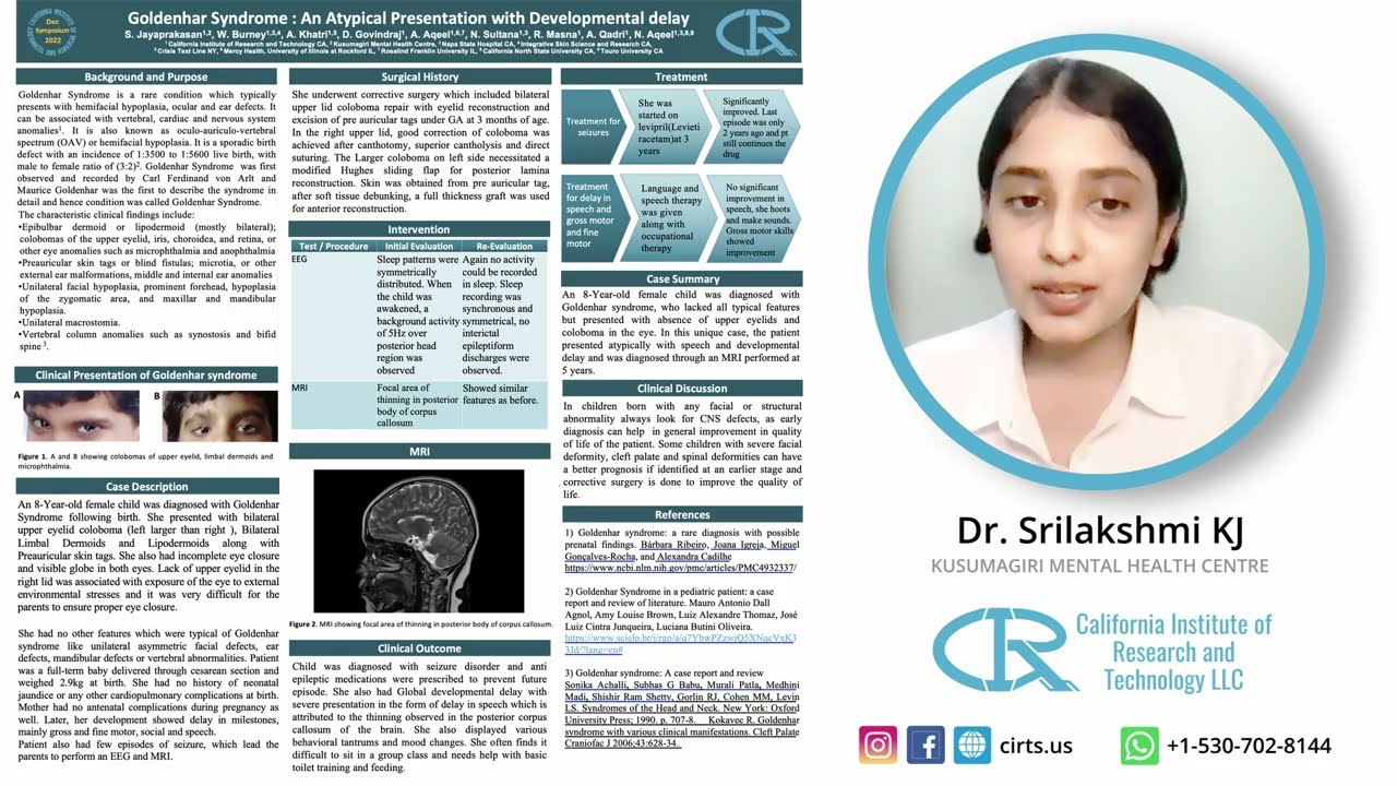 Goldenhar Syndrome - Dr. Srilakshmi KJ