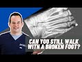 Can You Walk On A Broken Foot Dr Nick Campitelli