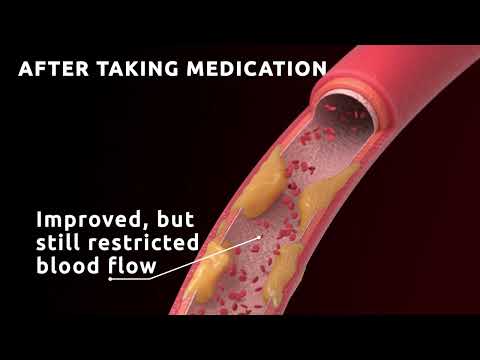 ED: Why does viagra and cialis stop working?