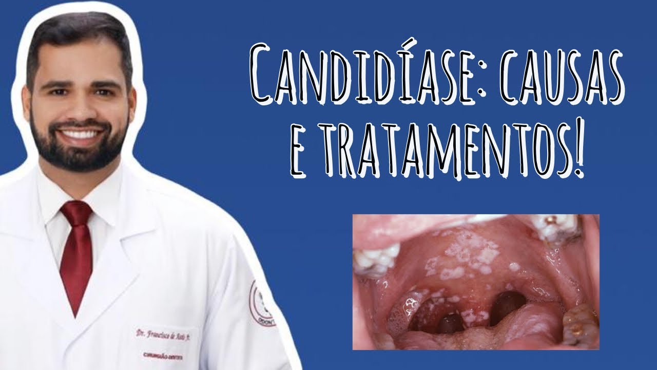 Francisco De Assis Almeida Lima Júnior-75