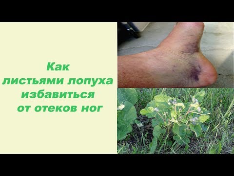Болит ли низ живота и поясница при беременности на Лечение суставов в оренбургской области