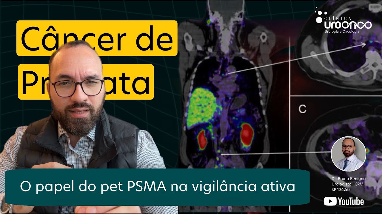 Capa do Vídeo