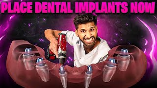 I Placed 1,200+ Implants as a New Grad Dentist. Heres How To Do It.