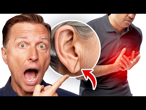 Weird Symptoms Explained by Dr Berg
