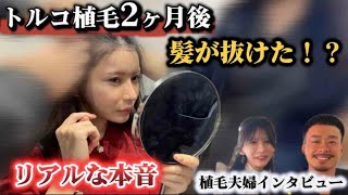 トルコ植毛🇹🇷【植毛夫婦】が語るリアルな本音＜奥さまのぷくちゃん編＞