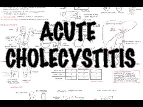 Acute Cholecystitis - Overview