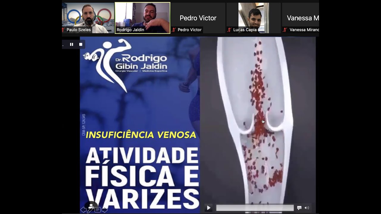 RECOMENDAÇOES DE EXERCÍCIO NA INSUFICIÊNCIA VENOSA E EVIDENCIAS DA ELASTOCOMPRESSÃO