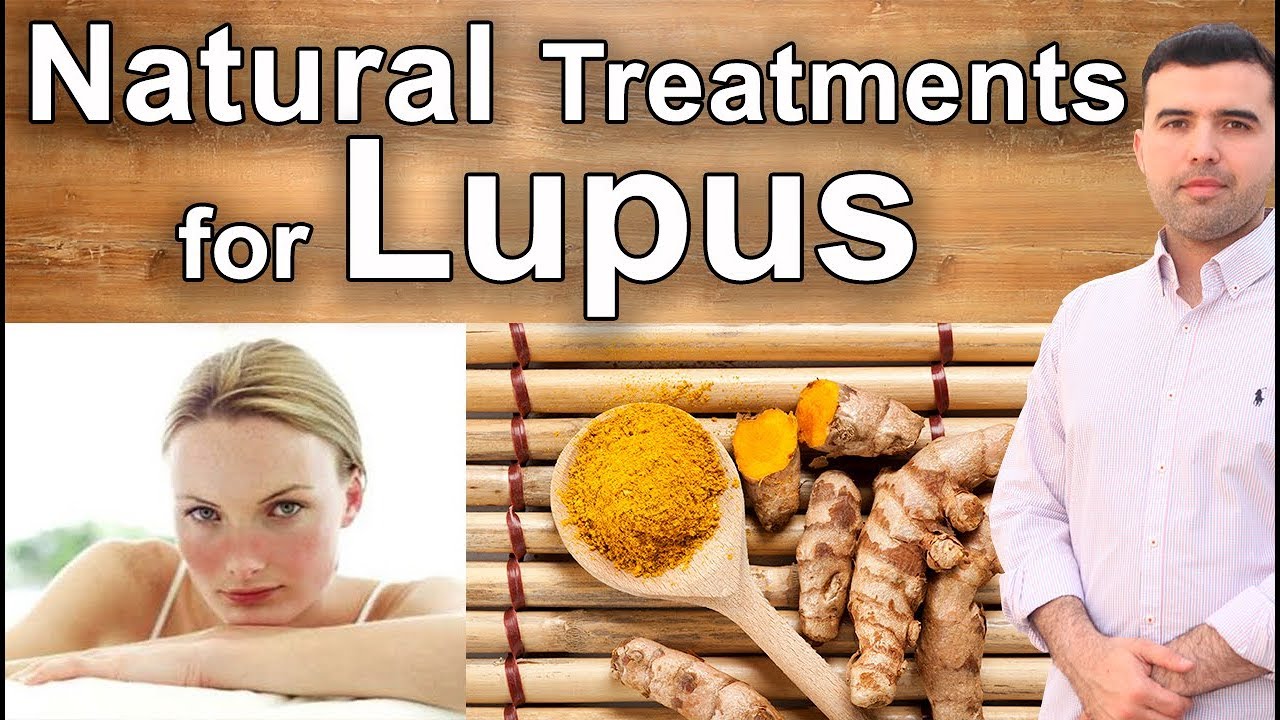 The Best Natural Treatments for Lupus – What Few Know
