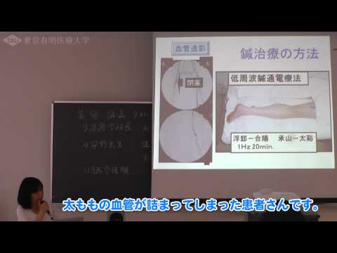 冷え性にも効果的！ はり治療で血流が良くなった例 【東京有明医療大学】