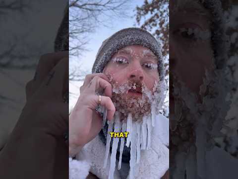 Coldest place on Earth😱