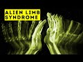 Alien Hand Syndrome Bizarre Condition Explained Mental Health Documentary