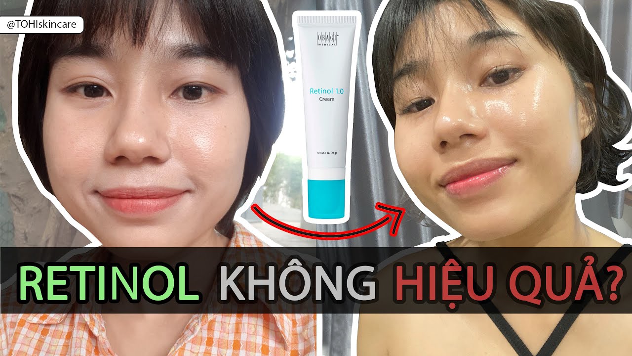 Retinol | Tại sao dùng Retinol mãi không đẹp | Tờ Hi