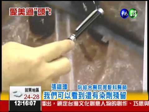 染髮太頻繁! 婦頭皮灼傷發癢