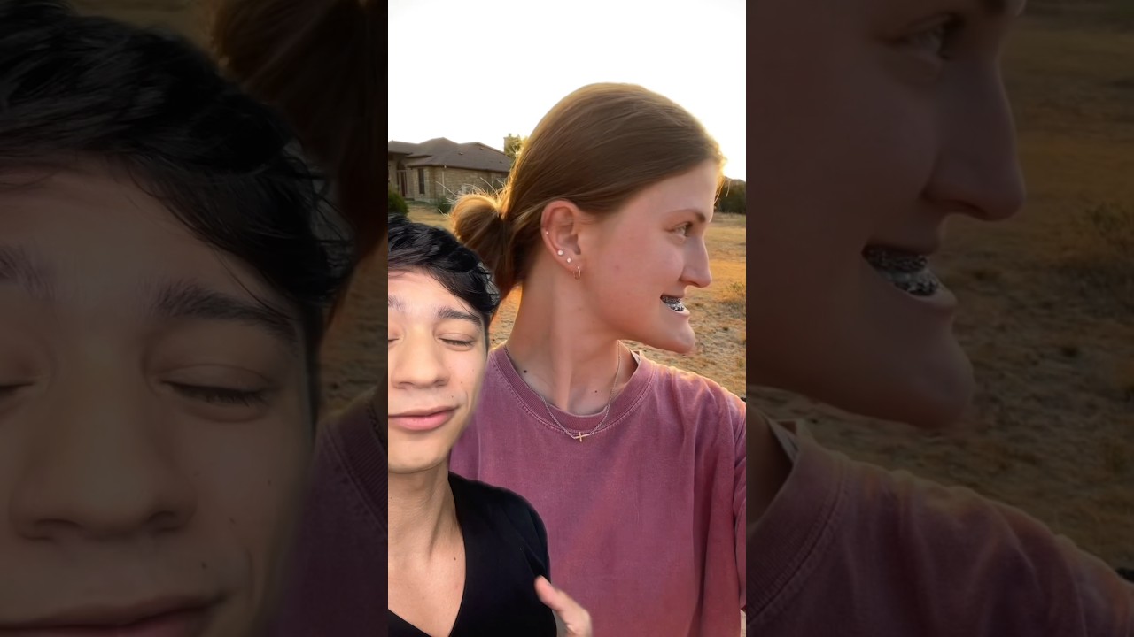 Ela fez Diminuição do Queixo. Antes e Depois ! #shorts