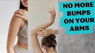 How to get rid of Bumps on your arms / The best remedy for Keratosis Pilaris