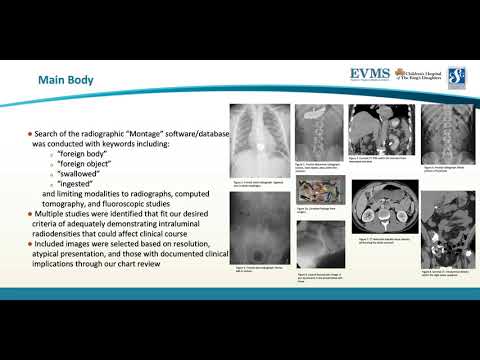 Thumbnail image of video presentation for Appearance of intra-abdominal foreign bodies on multiple radiologic modalities