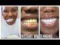 How I whitened  my yellow teeth in 2 Minutes | LIVE DEMO (HOME REMEDY)