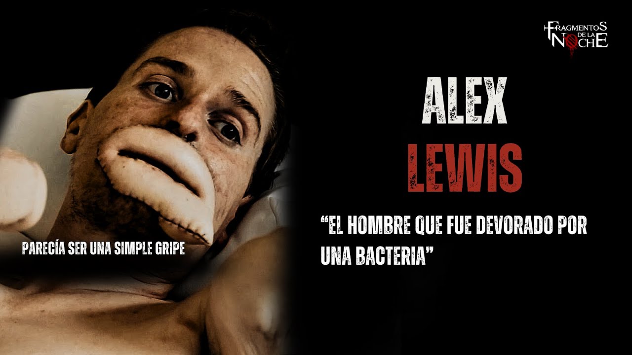 El caso de Alex Lewis "Fue devorado por una bacteria" | Fragmentos de la Noche