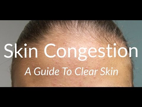 download lagu mp3 mp4 What Is Congested Skin, download lagu What Is Congested Skin gratis, unduh video klip What Is Congested Skin