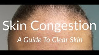 How-To Clear Skin Congestion | Bumpy Skin | Blackheads | Whiteheads