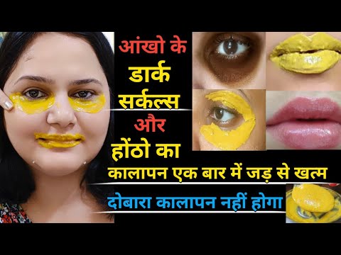 आंखो के डार्क सर्कल्स / होंठों का कालापन जड से खत्म करो | Dark Circles Removal | Dark Lips Treatment