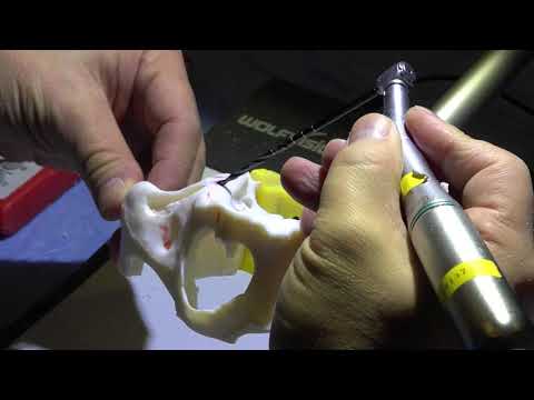 Training course - Zygoma Implant Demonstration by Dr. Chow