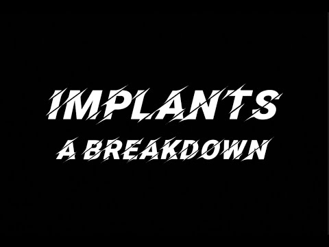 Implants - A Breakdown