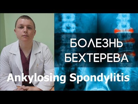 Шейный остеохондроз 2 степени сколько лет можно прожить Сабельник вылечит остеохондроз или нет