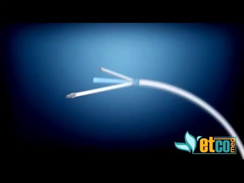 Cooling Boody temp by catheter كيف يتحكم هذا الجهاز في حرارة الجسم بسرعة عن طريق القسطرة؟