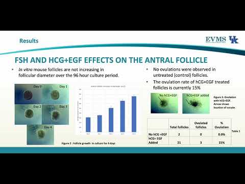 Thumbnail image of video presentation for Mouse Ovarian Follicles In Vitro - A Model to Study Ovulation