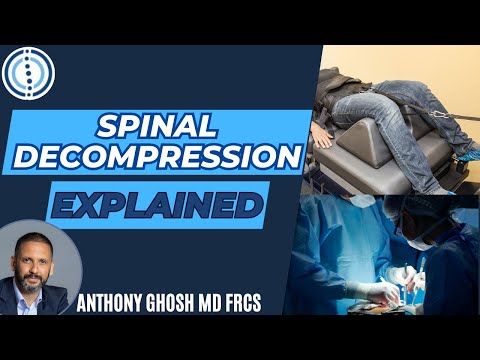 What is Spinal Decompression? Spine surgeon explains