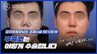 이 정도 구축코도 복원됩니다. 불가능을 가능으로 만든 재건 수술