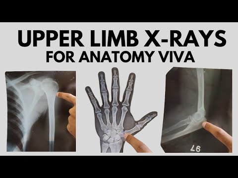 Upper Limb Radiological Anatomy | For Anatomy Viva