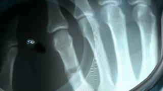 FORD & LOPATIN - Emergency Dub.