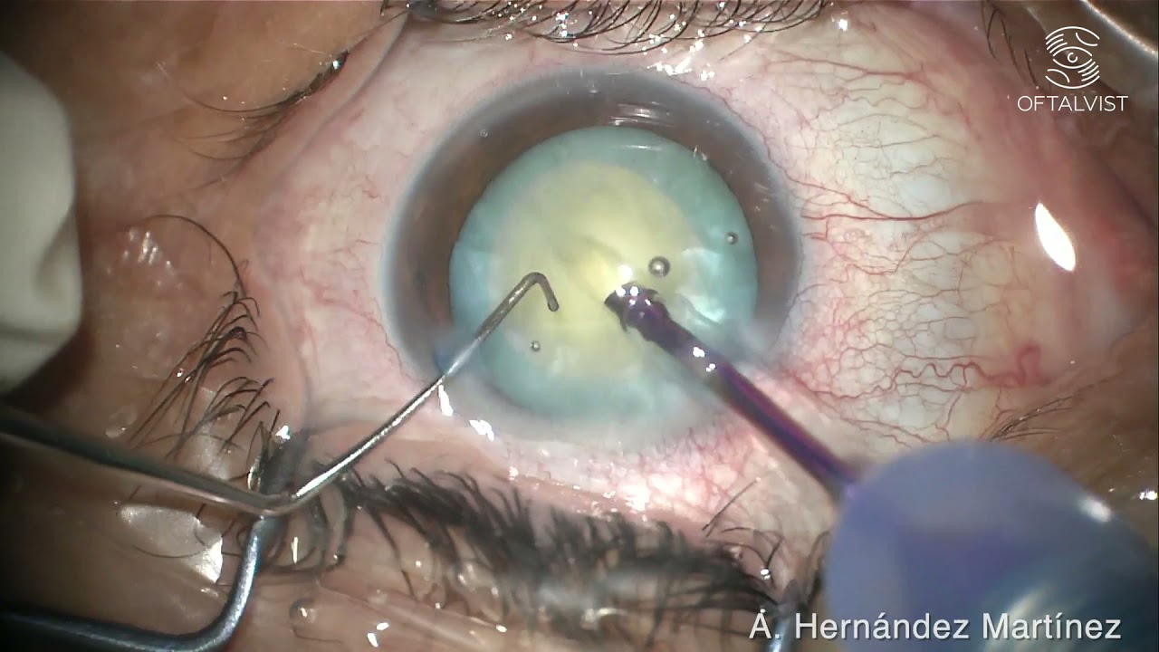 Adrián Hernández Martínez-9