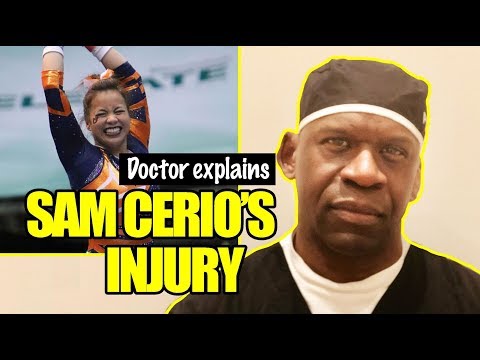 Auburn Gymnast SAM CERIO KNEE DISLOCATION | Doctor Explains Sports Injuries - Dr. Chris Raynor Video