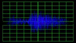 Harry Hudson's Melody Men - Misery Farm (Edison Bell Radio, 1929)