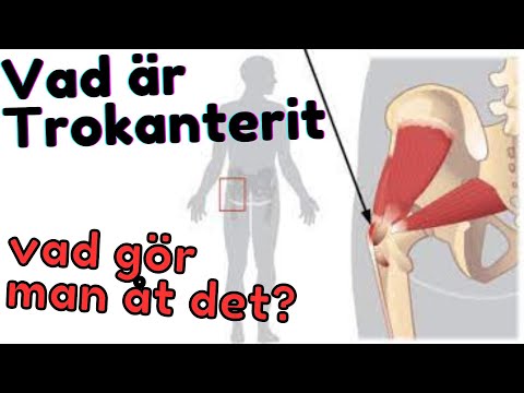 Vad är Trokanterit och vad gör man åt det